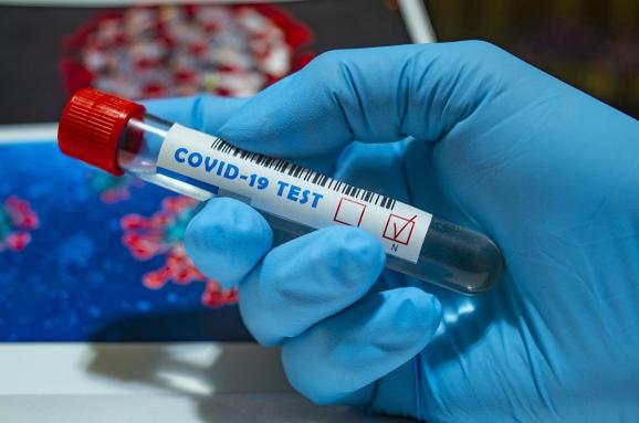 На Херсонщині на коронавірус захворіли 322 людини