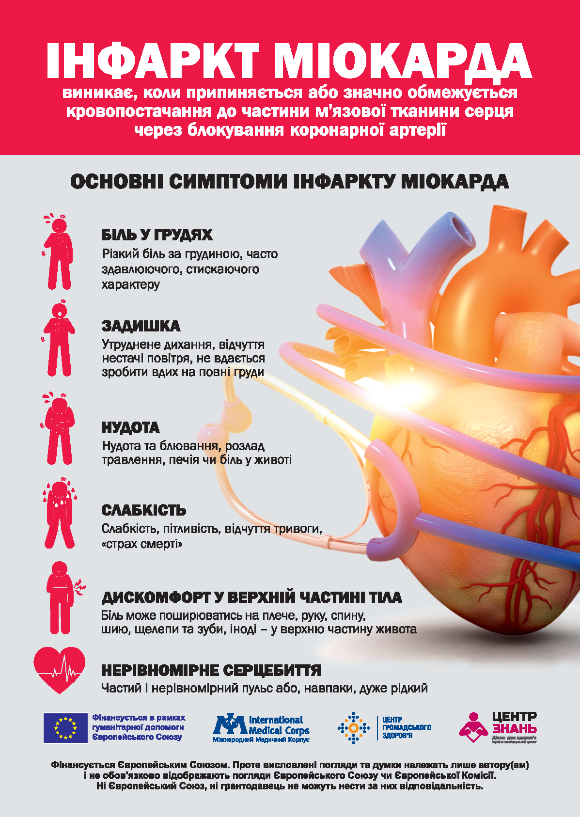 Інформаційний плакат про інфаркт міокарда з описом його причин та основних симптомів: біль у грудях, задишка, нудота, слабкість, дискомфорт у верхній частині тіла та нерівномірне серцебиття.