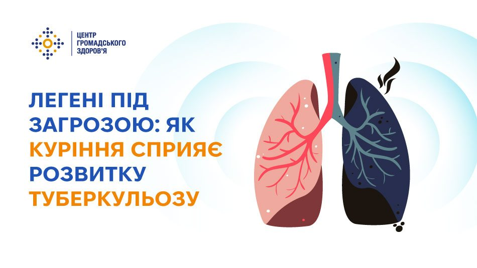Інформаційний банер із заголовком «ЛЕГЕНІ ПІД ЗАГРОЗОЮ: ЯК КУРІННЯ СПРИЯЄ РОЗВИТКУ ТУБЕРКУЛЬОЗУ», ілюстрацією здорової та ураженої курінням легені, а також логотипом «Центру громадського здоров'я».