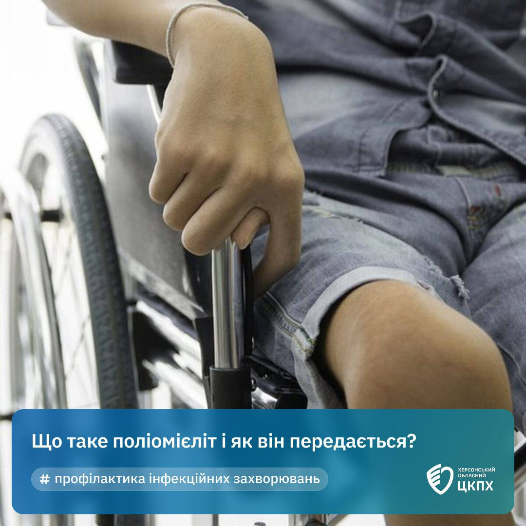 На світлині показано людину в сірих шортах і футболці, яка сидить у кріслі колісному, поклавши праву руку на металевий підлокітник; нижню третину кадру перекриває темно-синя інформаційна плашка з білим текстом «Що таке поліомієліт і як він передається?», хештегом «# профілактика інфекційних захворювань» та білим круглим логотипом у вигляді стилізованого серця з написом «ХЕРСОНСЬКИЙ ОБЛАСНИЙ ЦКПХ» у правому нижньому кутку.