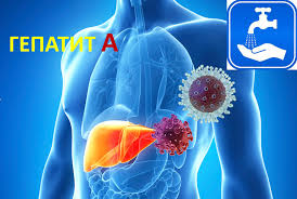 Медична 3D-ілюстрація торса людини, де підсвічено печінку та зображено віруси. На малюнку присутній напис «ГЕПАТИТ А» та піктограма миття рук під краном як символ гігієни.